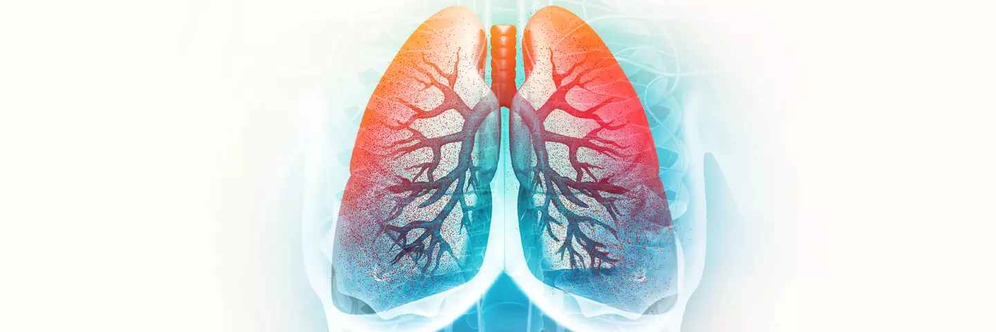 bronquitis_aguda