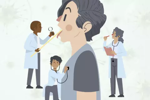 ilustración_amigdalitis_previewimage