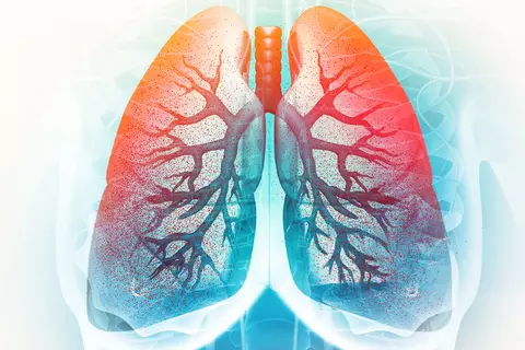 bronquitis_aguda
