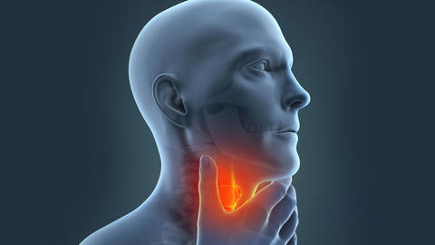 dolor_de_garganta